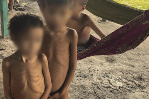 Malnourished children in a Yanomami village. 