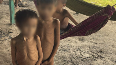 Malnourished children in a Yanomami village. 