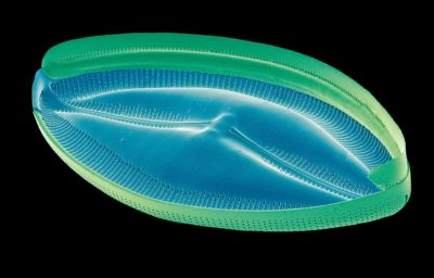 A colored image of a diatom captured using an electron microscope.