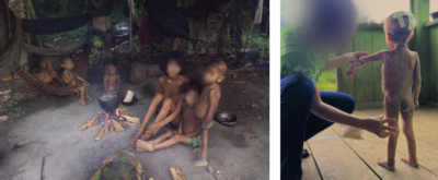 These photos were taken in Yanomami territory by Indigenous people and health workers in recent months.